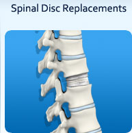Spinal Disk Replacements- Peak Orthopedics & Spine