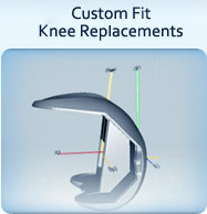 Custom Fit and Robotic Knee Replacement - Peak Orthopedics & Spine